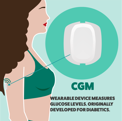 CGM