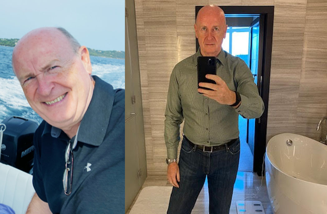Before and After for homepage copy
